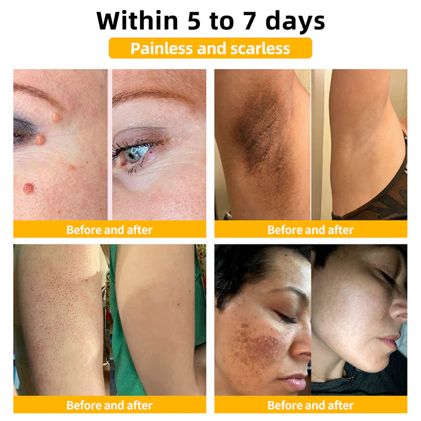 Turonu™ Bee Venom Skin Treatment Cream(Meets BAD standards)