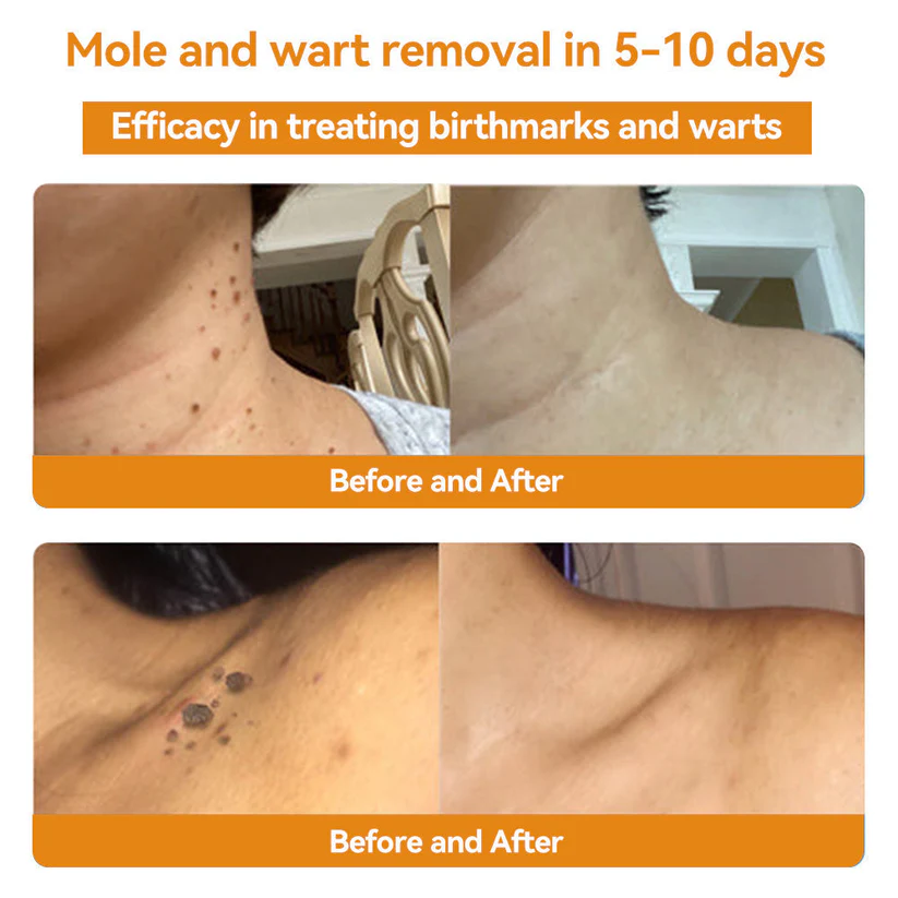 Turonu™ Bee Venom Skin Treatment Cream(Meets BAD standards)
