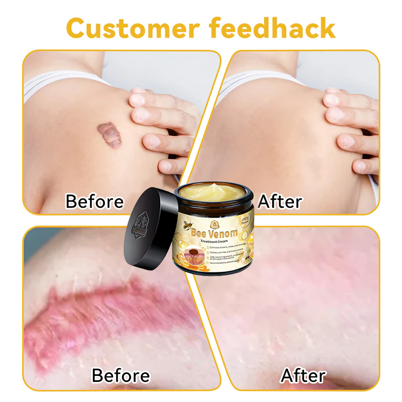 Turonu™ Bee Venom Skin Treatment Cream(Meets BAD standards)