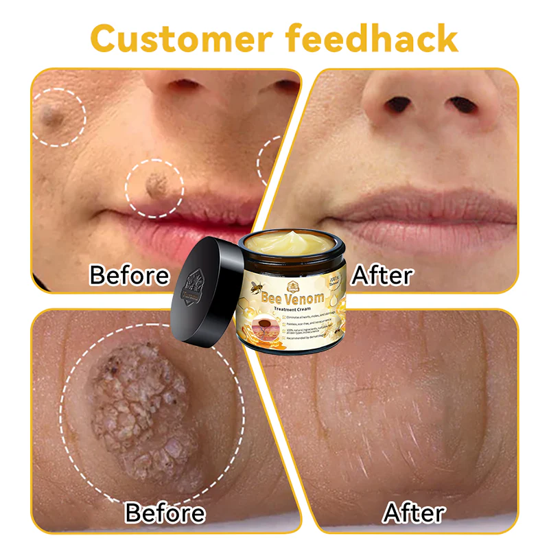 Turonu™ Bee Venom Skin Treatment Cream（Meets BAD standards）