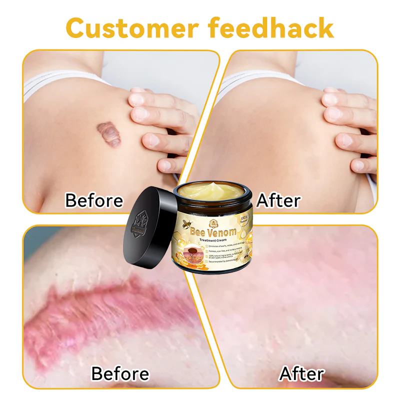 Turonu™ Bee Venom Skin Treatment Cream（Meets BAD standards）