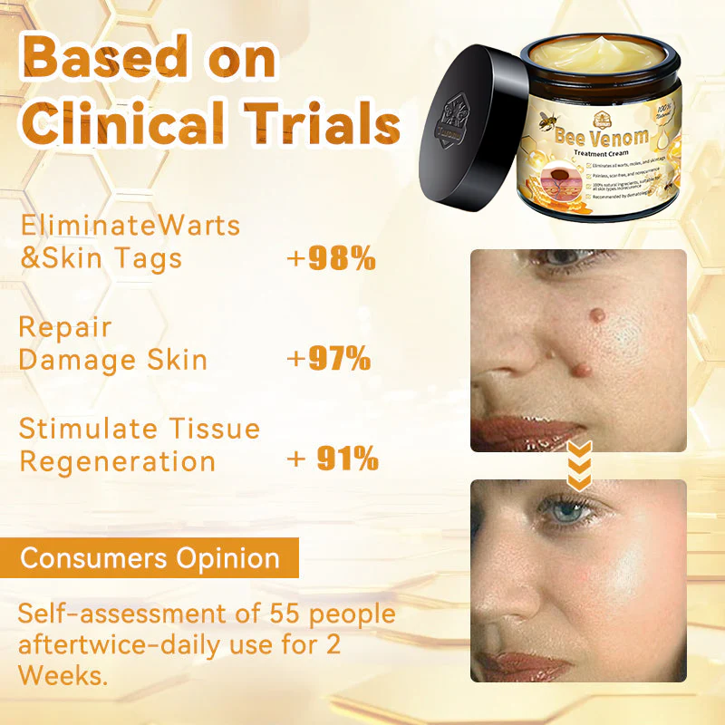 Turonu™ Bee Venom Skin Treatment Cream（Meets BAD standards）